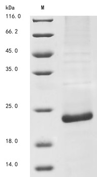 Genome polyprotein, partial, Bovine viral diarrhea virus, recombinant