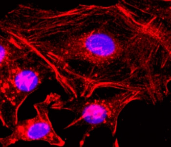 Anti-Beta Actin, clone RM112