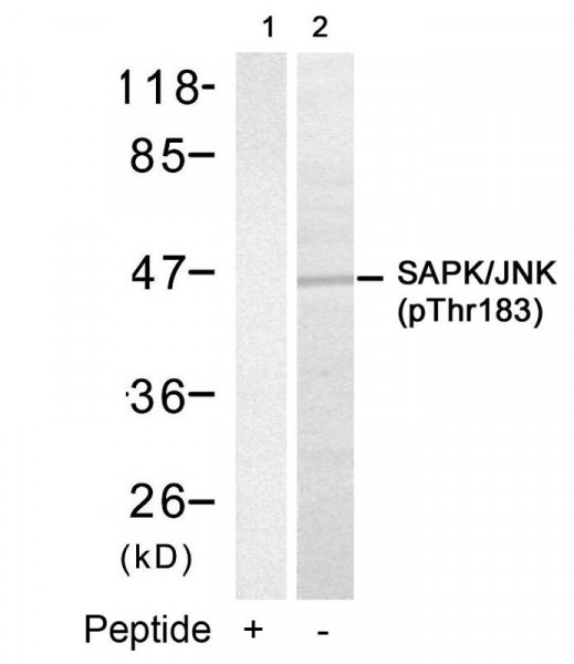 Anti-phospho-SAPK/JNK (Thr183)