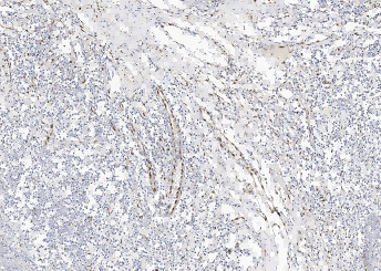 Anti-IL-33 Monoclonal Recombinant Antibody