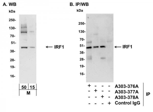 Anti-IRF1