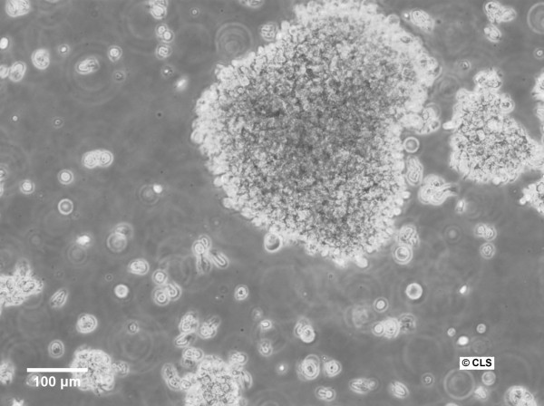 B-LCL-HROC102 Cells