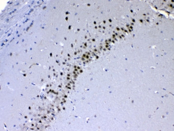 Anti-CHD2 / Chromodomain-helicase-DNA-binding protein 2