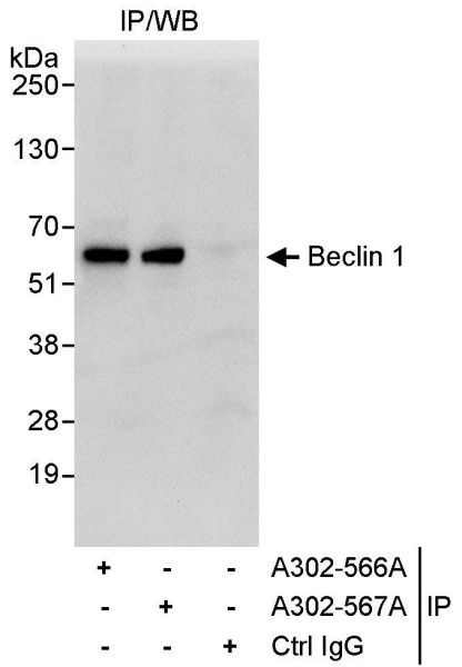 Anti-Beclin 1