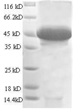 Stanniocalcin-1 (STC1), partial, human, recombinant
