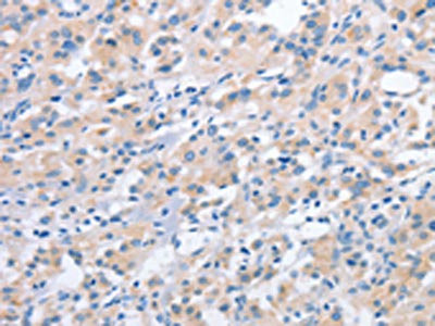 Anti-NCAPD2