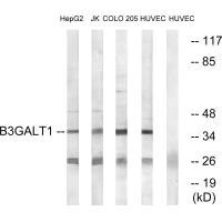 Anti-B3GALT1