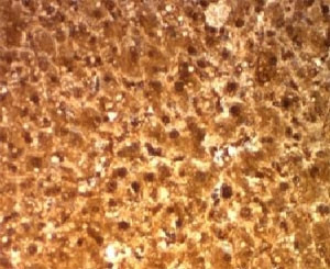 Anti-Arginase 1, clone ARG1/1126