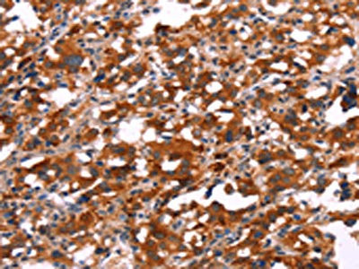 Anti-SLC6A1