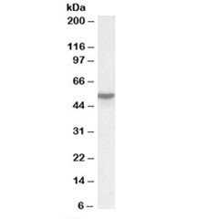 Anti-Vitamin D-binding protein
