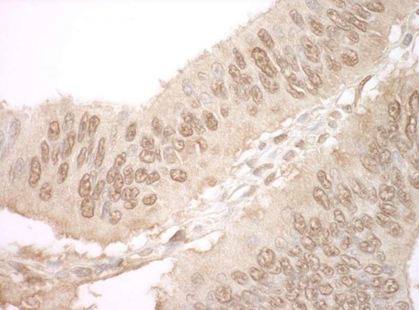 Anti-JMY (IHC)
