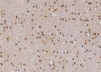 Anti-Sox2 Monoclonal Recombinant Antibody
