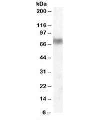 Anti-Lactoperoxidase