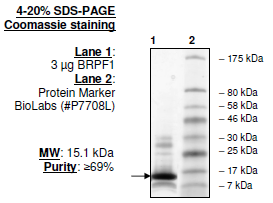 BRPF1 (627-746), human recombinant protein, N-terminal His tag