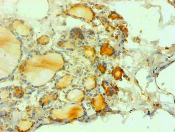 Anti-CALCA Monoclonal, clone 4G1H7