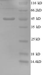 Golgi membrane protein 1 (GOLM1), partial, human, recombinant