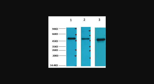 Anti-FH/Fumarase, monoclonal