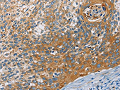 Anti-KCNMA1