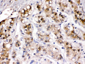 Anti-Ceruloplasmin