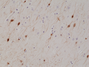 Anti-Calretinin (human), Rabbit Monoclonal (RM324)