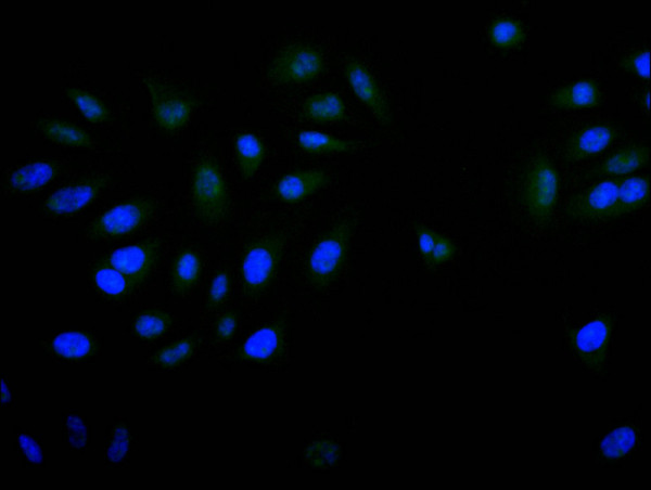 Anti-PITX3 Recombinant Monoclonal, clone 28A9