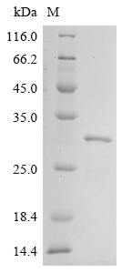 Collagen alpha-1(XI) chain (COL11A1), partial, human, recombinant