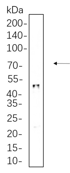 Anti-Recombinant HNF-3alpha, clone 6H4
