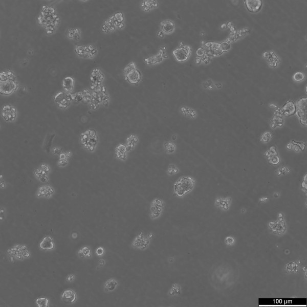 HROC147Met1 Cells