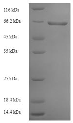 Glycoprotein (G), partial, Rabies virus, recombinant