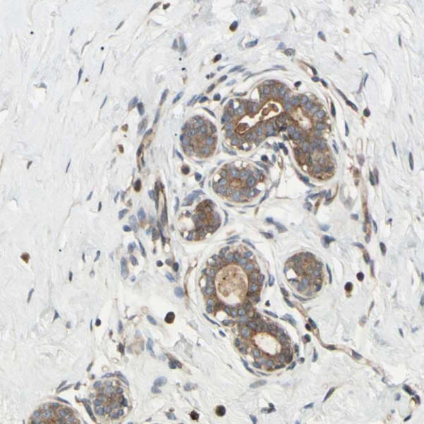 Anti-SPTLC1