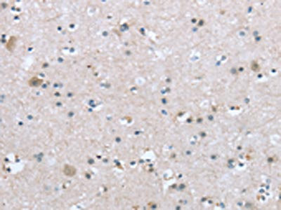 Anti-TRPM3