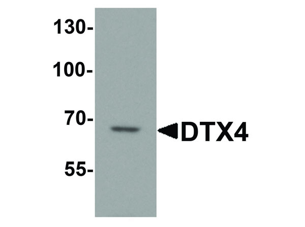 Anti-DTX4