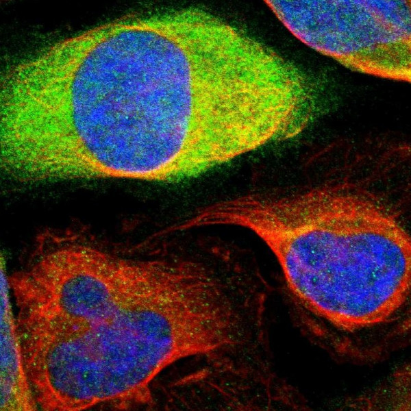 Anti-CCNB2
