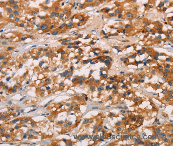 Anti-CD80