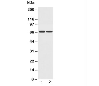 Anti-GLUT12