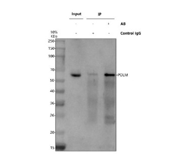 Anti-POLM / DNA polymerase mu