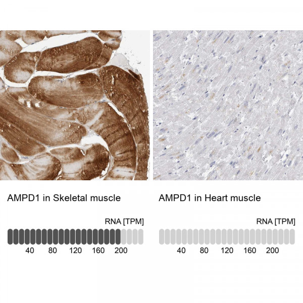 Anti-AMPD1