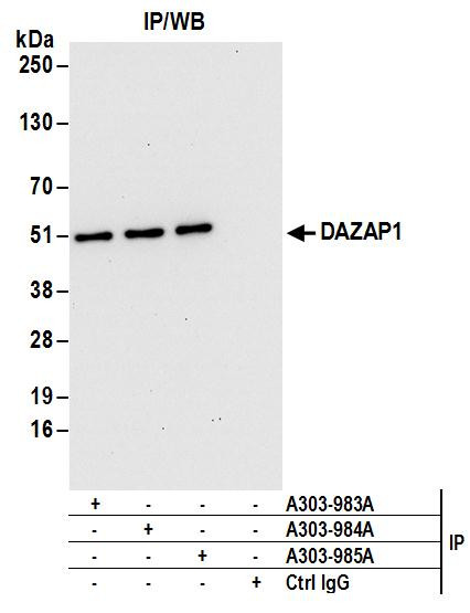 Anti-DAZAP1
