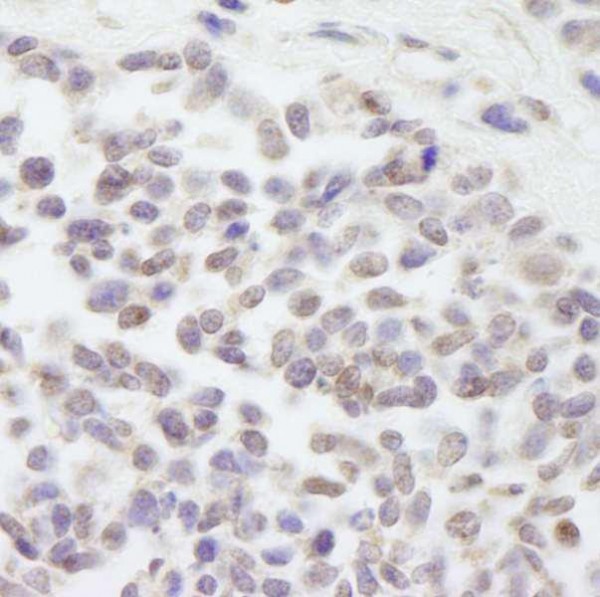 Anti-Cul3 (IHC)