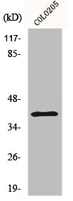 Anti-RRM2B