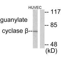 Anti-GUCY1B3