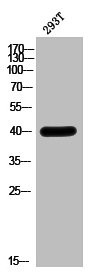 Anti-HOXA5