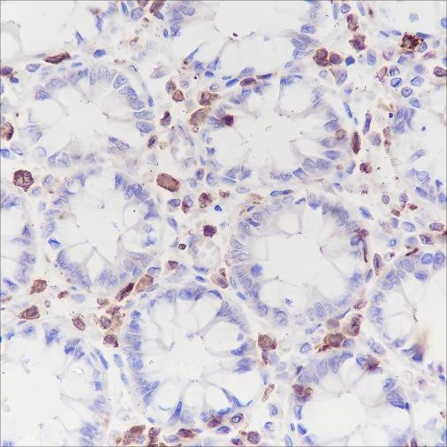 Anti-Recombinant CSF-1R, clone A195