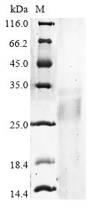 Ribonuclease T2 (RNASET2), human, recombinant