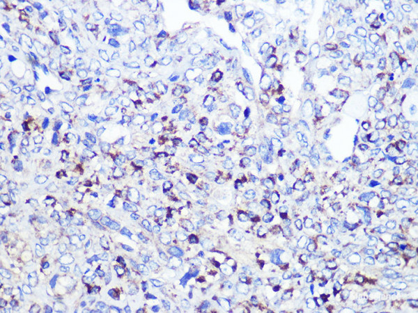 Anti-CD68