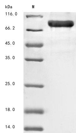 Receptor-interacting serine/threonine-protein kinase 1 (Ripk1), mouse, recombinant