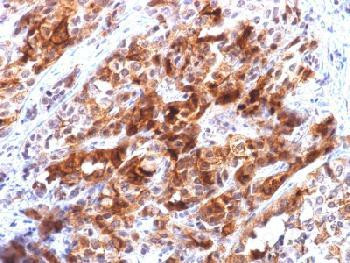 Anti-Glypican-3 (GPC3) (Hepatocellular Carcinoma Marker) (clone: rGPC3/863) (recombinant monoclonal)
