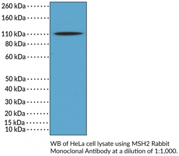 Anti-MSH2 Rabbit Monoclonal Antibody (Clone RM375)
