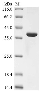 Galectin-4 (Lgals4), mouse, recombinant