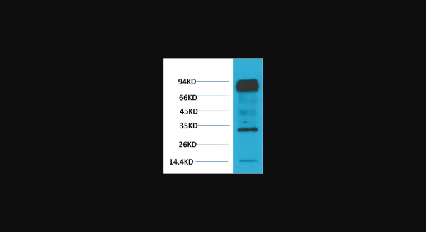 Anti-HIF-1 beta/ARNT, monoclonal